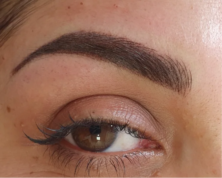 After Combined Brows