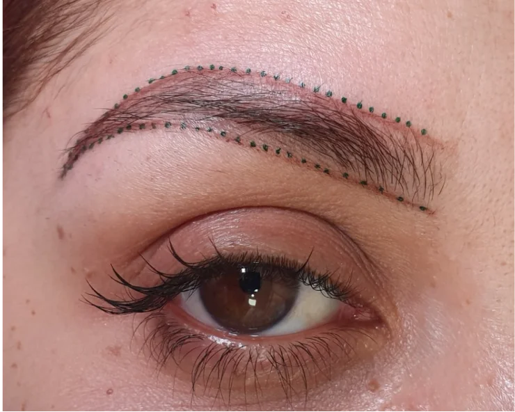 Before Combined Brows