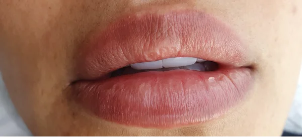 Before Diamond Lips