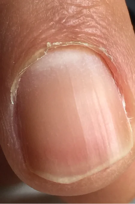 Before Manicure