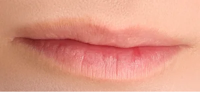 Glazy Lips Before
